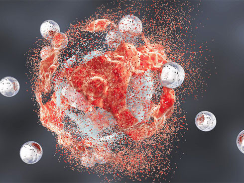 Phẫu thuật cứu người phụ nữ có hàng trăm khối u xõa như cánh đại bàng-2