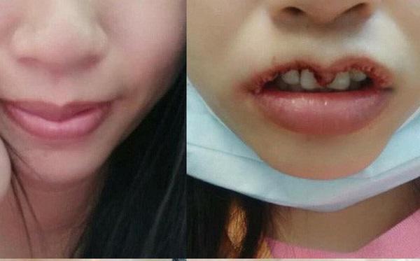 Khi bạn muốn đôi môi trái tim, còn bác sĩ lại muốn khắc nguyên hình trái tim lên mặt bạn...-4