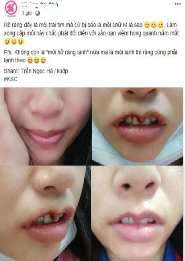 Khi bạn muốn đôi môi trái tim, còn bác sĩ lại muốn khắc nguyên hình trái tim lên mặt bạn...-3