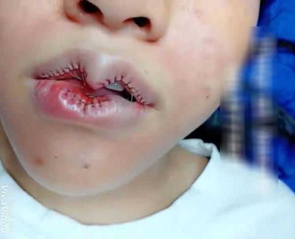 Khi bạn muốn đôi môi trái tim, còn bác sĩ lại muốn khắc nguyên hình trái tim lên mặt bạn...-6