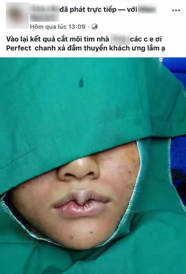 Khi bạn muốn đôi môi trái tim, còn bác sĩ lại muốn khắc nguyên hình trái tim lên mặt bạn...-5