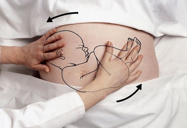 Tròn mắt xem bác sĩ dùng 2 tay xoay ngôi thai từ ngôi ngược thành ngôi thuận chỉ trong chưa đầy 1 phút-7