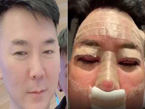 Sau ly hôn, vợ cũ Phan Thanh Bình, Thu Thuỷ... dao kéo đẹp hơn xưa gấp bội-19