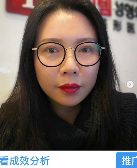 Nhà tạo mẫu tóc nổi tiếng lên tiếng cảnh báo mọi người sau khi sang Hàn Quốc phẫu thuật thẩm mỹ hỏng-3