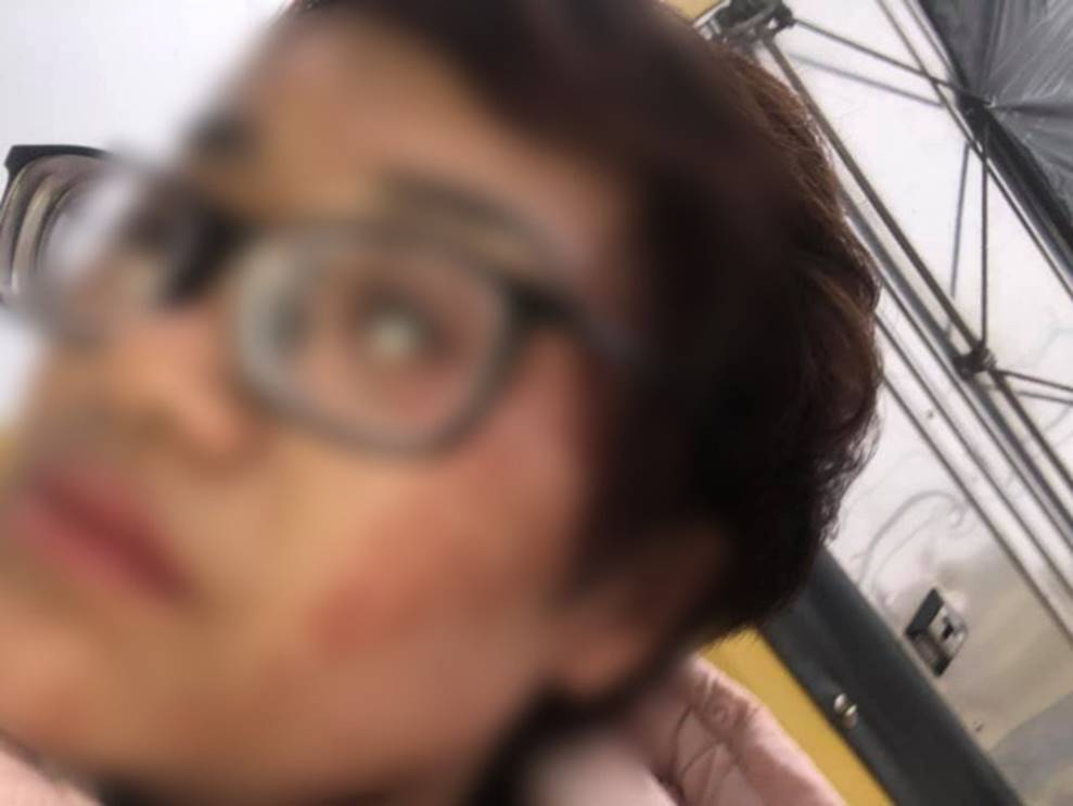 Thắc mắc tiền vé xe khách tăng thêm 100 nghìn, người phụ nữ bị túm tóc đập đầu đến chảy máu: Tài xế lên tiếng-2