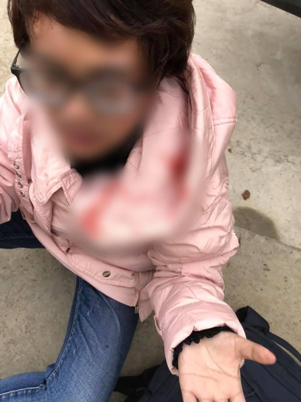 Thắc mắc tiền vé xe khách tăng thêm 100 nghìn, người phụ nữ bị túm tóc đập đầu đến chảy máu: Tài xế lên tiếng-3