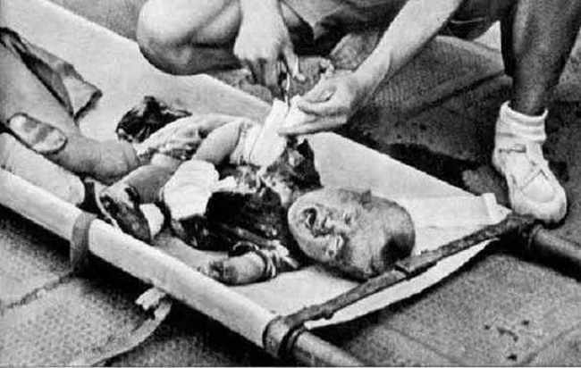 Bức ảnh đứa bé ngồi khóc trên đống đổ nát và câu chuyện đau lòng phía sau khiến cả thế giới phải ám ảnh-3