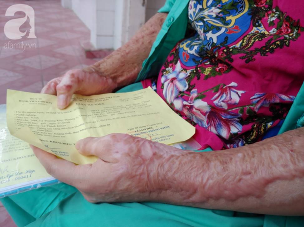 Thương tâm mẹ trẻ bị lửa xăng đốt nát da thịt, một mình chống chọi đau đớn trong viện: Giờ tôi chỉ sống vì con”-9