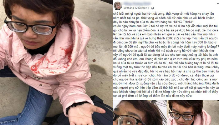 Phản ứng nhà xe tăng giá vé dịp nghỉ Tết, nữ hành khách bị đánh phải nhập viện-1