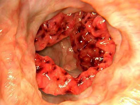 Kết hợp món ăn này với nhau có thể biến thành chất độc bảng A gây ung thư-4