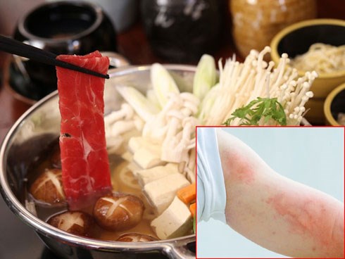 5 ngày liên tiếp ăn lẩu, người phụ nữ nhận cái kết... đắng