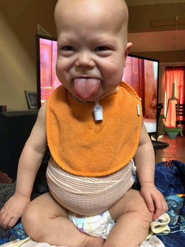 Hào hứng khen bé lè lưỡi đáng yêu khi siêu âm, ngày sinh ra mẹ thẫn thờ nhìn mặt con-2