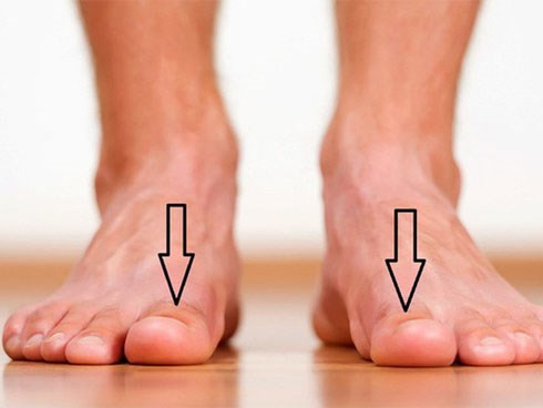 Bàn chân xuất hiện cùng lúc 3 dấu hiệu này: Hãy cảnh giác vì có thể thận đang có bệnh