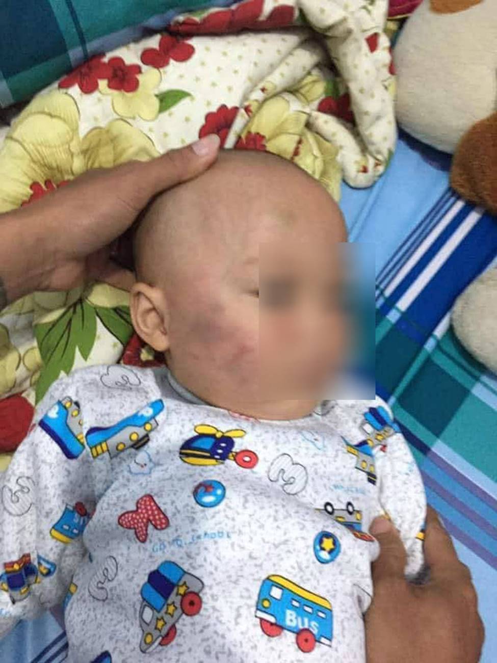 Vĩnh Long: Bé trai 19 tháng tuổi bị bảo mẫu tát liên tục vào mặt, phải nhập viện điều trị-1