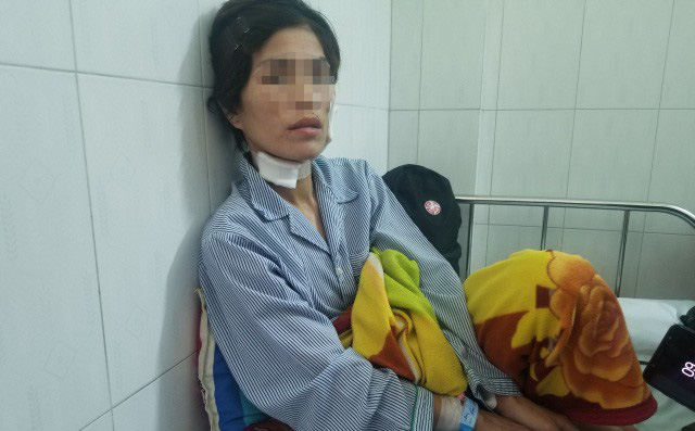 Sau ly hôn, chồng cũ bạo hành, cắt tai của vợ-1