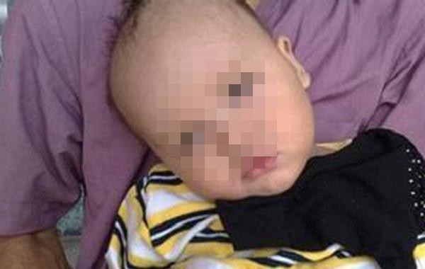 Bé 8 tháng tuổi học bò bỗng im lặng đờ đẫn, sau khi kiểm tra mẹ gào khóc phát hiện con bị bại não vì hành động của mình-1