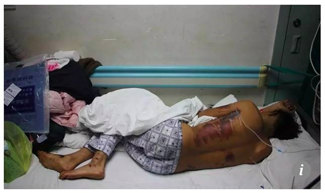 Chú rể kiện bạn bè vì bị ném trứng, đâm xe trong ngày cưới-2