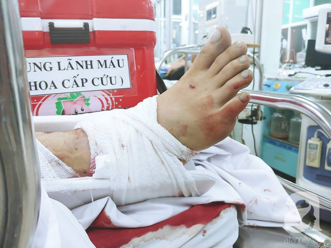 Thông tin mới nhất: 2 nạn nhân trong vụ container tông loạt xe máy ở Long An sắp được xuất viện-3