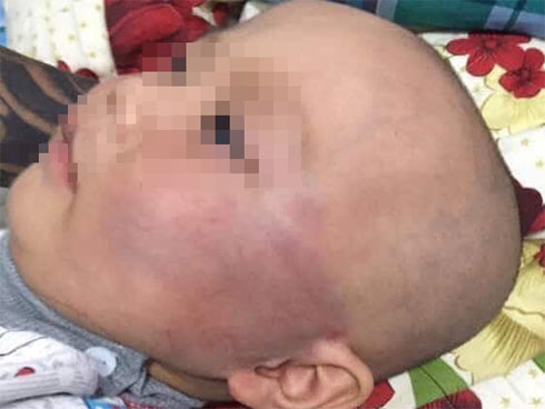 Vợ bỏ đi khi biết con trai bại não, câu nói của người chồng khiến bao người nín lặng-6