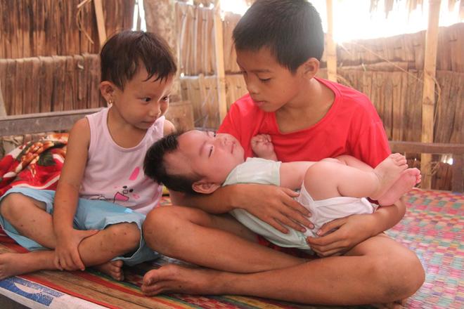 Vợ bỏ đi khi biết con trai bại não, câu nói của người chồng khiến bao người nín lặng-5