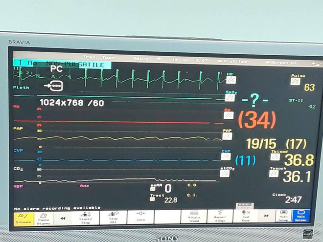 Những cuộc hồi sinh kỳ diệu nhờ người đã chết trong năm 2018-7