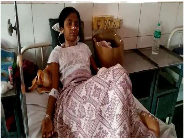 Ba người trong một gia đình bị bỏng vì smartphone bất ngờ phát nổ khi đang sạc-2