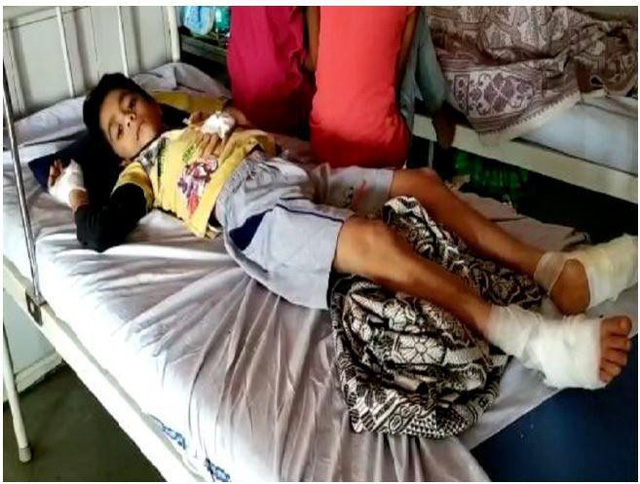 Ba người trong một gia đình bị bỏng vì smartphone bất ngờ phát nổ khi đang sạc-3