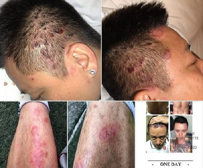 Loạt tai nạn khiến Tuấn Hưng thành sao Việt gặp vận đen nhất 2018-1