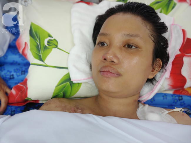 Mẹ mới sinh phải cắt cụt tứ chi sau khi bị áp xe vú: Bác sĩ sản khoa tiết lộ thông tin bất ngờ-9