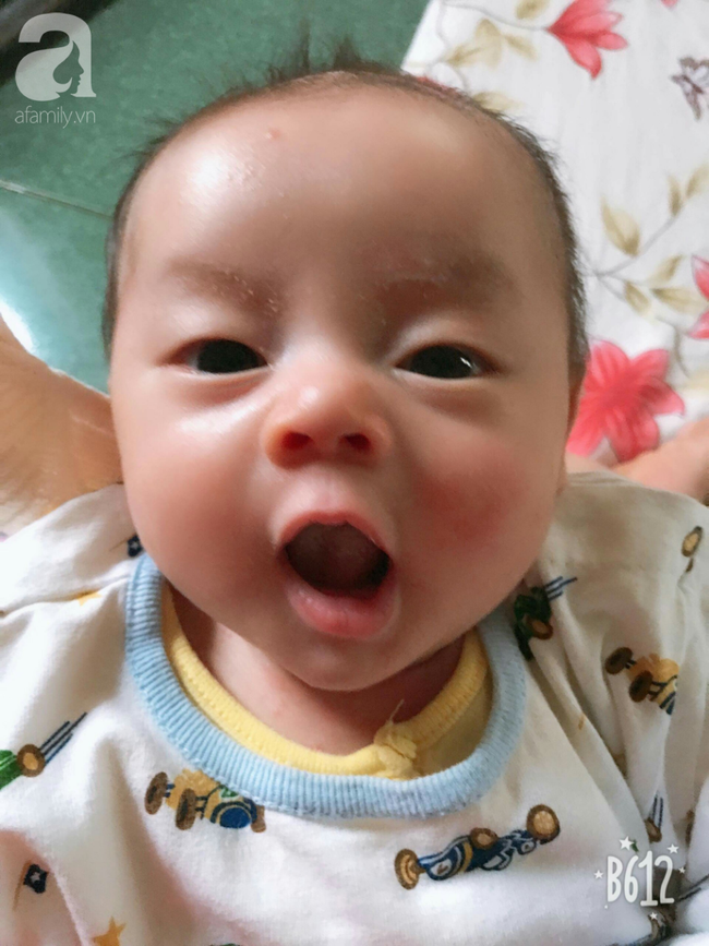 Mẹ mới sinh phải cắt cụt tứ chi sau khi bị áp xe vú: Bác sĩ sản khoa tiết lộ thông tin bất ngờ-4