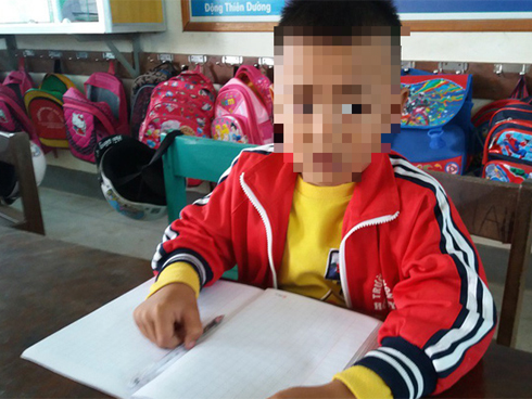 Cô giáo tường trình vụ lỡ tay tát học sinh lớp 1 chấn động sọ não-2