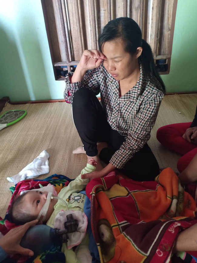Ánh mắt cầu cứu của bé trai 8 tháng sống phụ thuộc vào máy thở: Nếu ngừng bóp bình oxy con tôi sẽ ngưng thở”-7