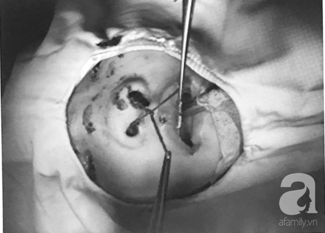 Thương tâm: Mẹ chở con không đội nón bảo hiểm, nhiều trẻ bị tai nạn cực nặng đến biến dạng mặt-2