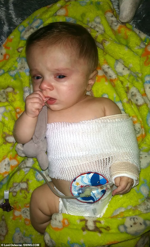 Đi siêu âm thấy xương con bị gãy, cha mẹ không ngờ đến điều khủng khiếp này xảy đến khi con chào đời-5