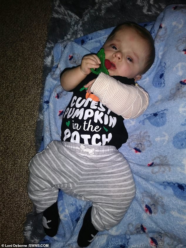 Đi siêu âm thấy xương con bị gãy, cha mẹ không ngờ đến điều khủng khiếp này xảy đến khi con chào đời-6