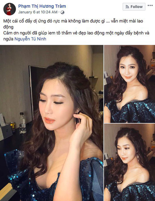 Cần làm gì để phòng tránh nguy cơ mắc chứng dị ứng cấp tính giống Hương Tràm trong thời tiết này?-5