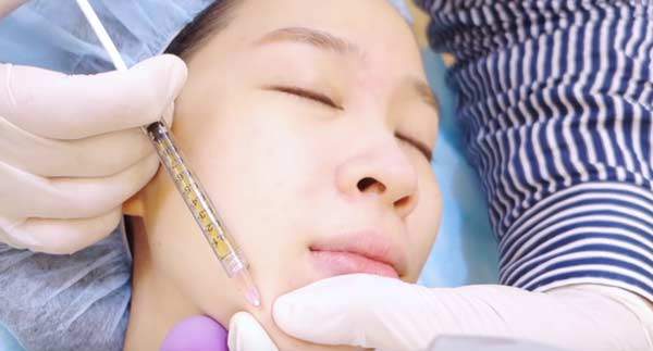 Bơm mỡ vào mặt như cô dâu Cao Bằng 62 tuổi: Có thực sự cải lão hoàn đồng?-1