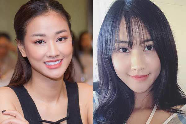 Bơm mỡ vào mặt như cô dâu Cao Bằng 62 tuổi: Có thực sự cải lão hoàn đồng?-2
