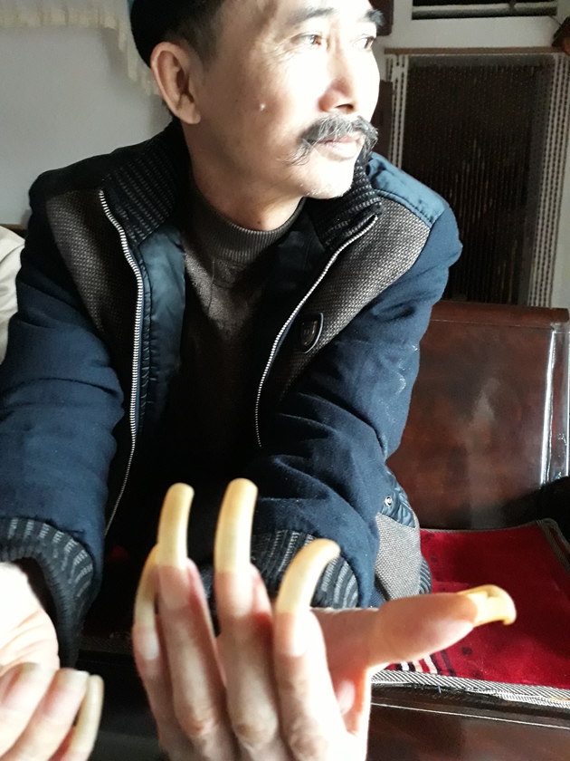 Người đàn ông bị vợ nhốt trong chuồng cọp hơn 3 năm ở Thanh Hóa-2