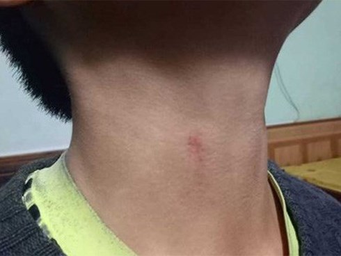 Thanh Hóa: Phụ huynh 'tố' hiệu trưởng bóp cổ học sinh vì... hát trong lớp