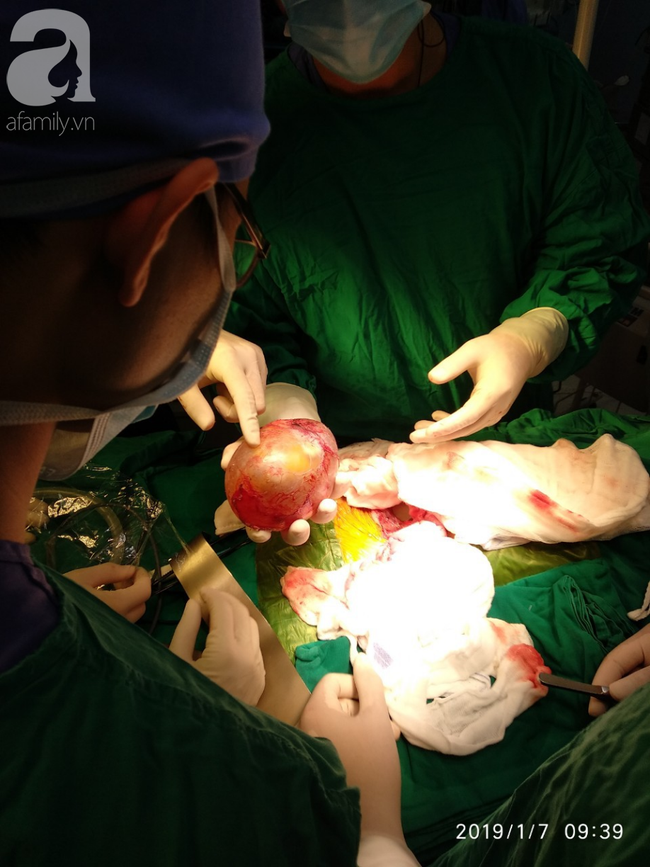 Hốt hoảng nhìn bé trai 4 tháng tuổi mang thai ký sinh vô cùng hiếm gặp, nửa triệu ca sinh mới có người mắc phải-4