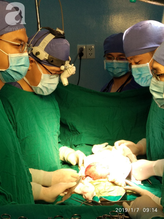 Hốt hoảng nhìn bé trai 4 tháng tuổi mang thai ký sinh vô cùng hiếm gặp, nửa triệu ca sinh mới có người mắc phải-2