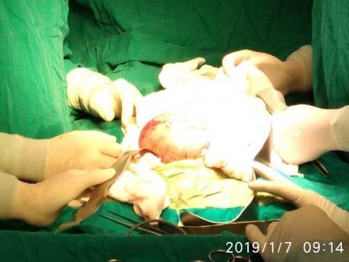Hốt hoảng nhìn bé trai 4 tháng tuổi mang