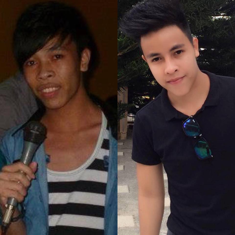 Bị bồ đá vì xấu, 2 chàng Tiền Giang, Đồng Tháp xây lại mặt đẹp như tài tử-5