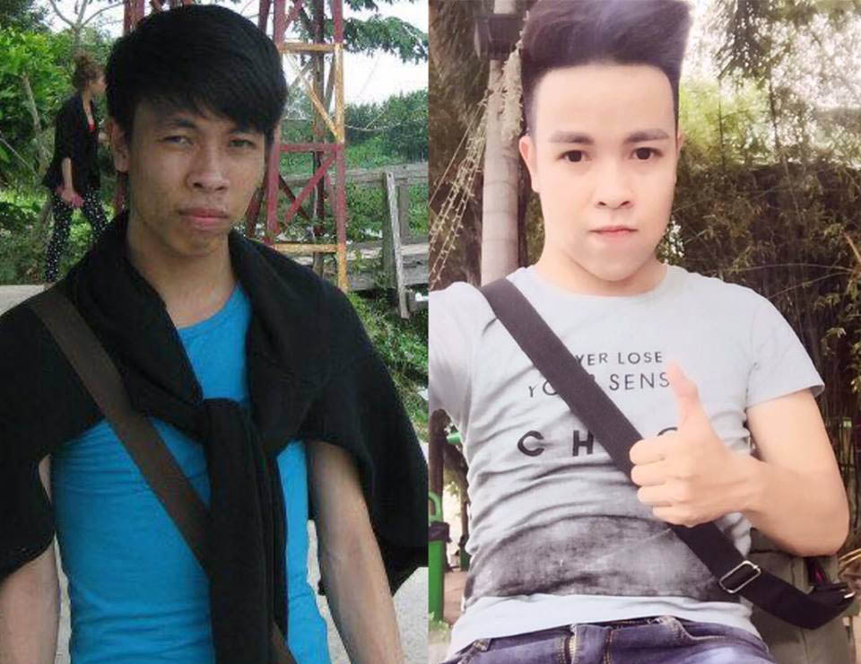 Bị bồ đá vì xấu, 2 chàng Tiền Giang, Đồng Tháp xây lại mặt đẹp như tài tử-6