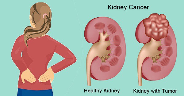 Bé gái 2 tuổi bị sỏi thận do mẹ thường làm một việc mà ai cũng tin rằng tốt cho trẻ con lẫn người lớn-4