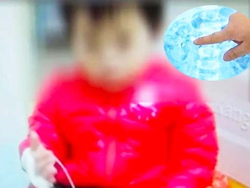 Bé gái 2 tuổi bị sỏi thận do mẹ thường làm một việc mà ai cũng tin rằng tốt cho trẻ con lẫn người lớn