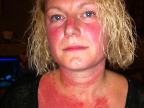 Nếu thường đau họng vào mùa xuân có thể là dấu hiệu cho thấy bạn đang bị bệnh này-5