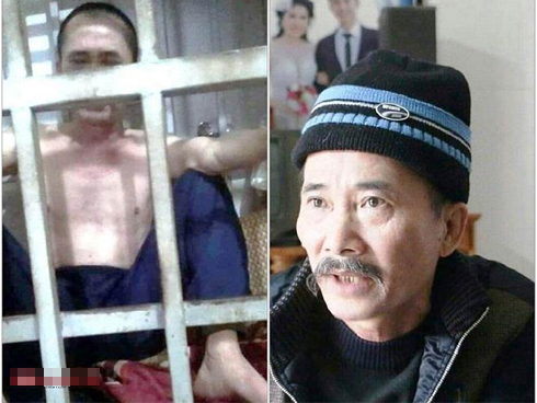 Vừa sạc vừa dùng điện thoại, thiếu niên 17 tuổi bị nát bàn tay-2