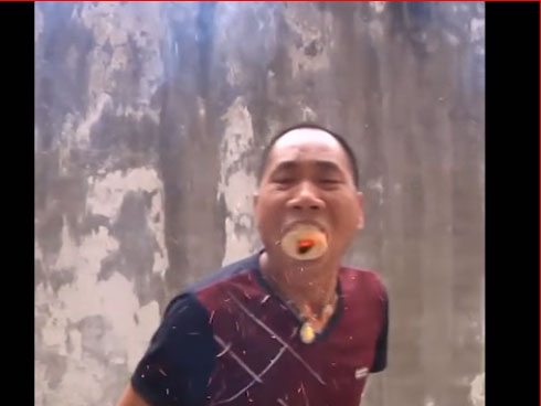 Không muốn tốn thêm tiền, chồng nhẫn tâm rút ống thở của vợ-1